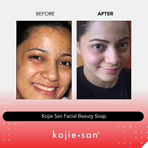 Kojie San Skin Brightening Soap – The Original Kojic Acid Soap that Reduces Dark Spots, Hyper-pigmentation, & other types of skin damage – 3 x 65g Bars