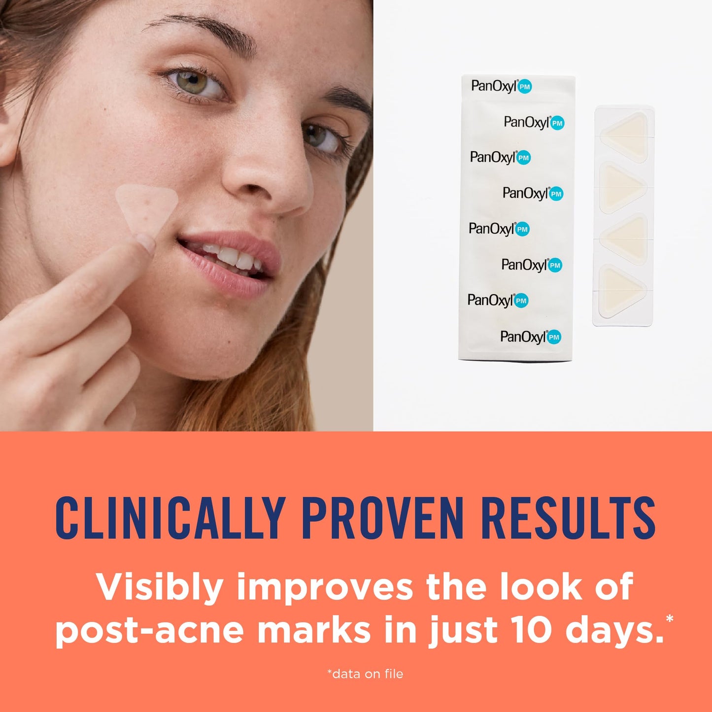 PanOxyl Blemish Brightening Patches: Dermatologist-Recommended, Help Fade Post-Acne Dark Spots and Reduce Redness, Large Clear Patches Cover a Bigger Area, Vegan & Latex-Free, 16ct