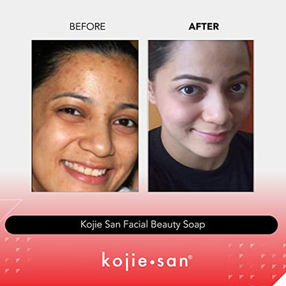 Kojie San Skin Brightening Soap – The Original Kojic Acid Soap that Reduces Dark Spots, Hyper-pigmentation, & other types of skin damage – 3 x 65g Bars