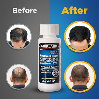 Kirkland Signature Minoxidil for Men 5% Extra Strength Hair Regrowth for Men vqzjBI, 1 Month Supply