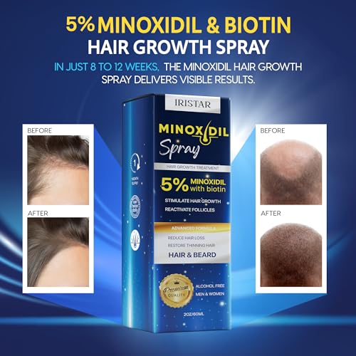 Minoxidil for Men, 5% Minoxidil for Women Hair Growth, Minoxidil for Men Beard Growth, Hair Regrowth for Men, Minoxidil 5 Percent, Hair Loss Treatments for Women 2oz