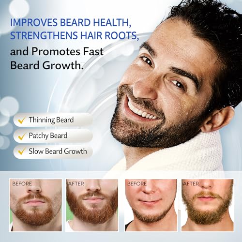Minoxidil for Men, 5% Minoxidil for Women Hair Growth, Minoxidil for Men Beard Growth, Hair Regrowth for Men, Minoxidil 5 Percent, Hair Loss Treatments for Women 2oz