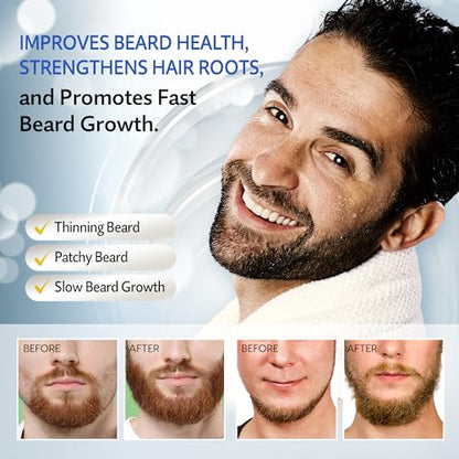 Minoxidil for Men, 5% Minoxidil for Women Hair Growth, Minoxidil for Men Beard Growth, Hair Regrowth for Men, Minoxidil 5 Percent, Hair Loss Treatments for Women 2oz
