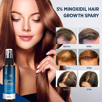 Hair Growth Serum 5% Minoxidil for Men and Women: Hair Regrowth Treatment for Stronger Thicker Longer Hair - With Biotin - Help to Stop Thinning and Loss Hair 100ML