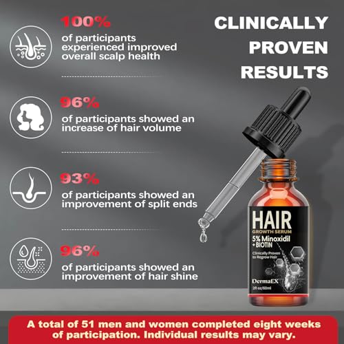 Hair Growth Serum, 5% Minoxidil & Biotin for Hair Growth for Women & Men, Hair Loss Treatments, Hair Regrowth Treatment for Thicker Longer Fuller Hair, 2 Fl Oz 1