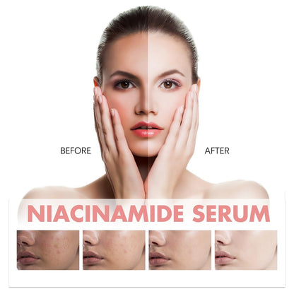 Peach 70 Niacinamide Serum,Peach 70% Niacin Serum for Face,Hydrating Serum,Face Serum for Women Face Plump & Smooth Fine Line Daily Clean Beauty (1pc)