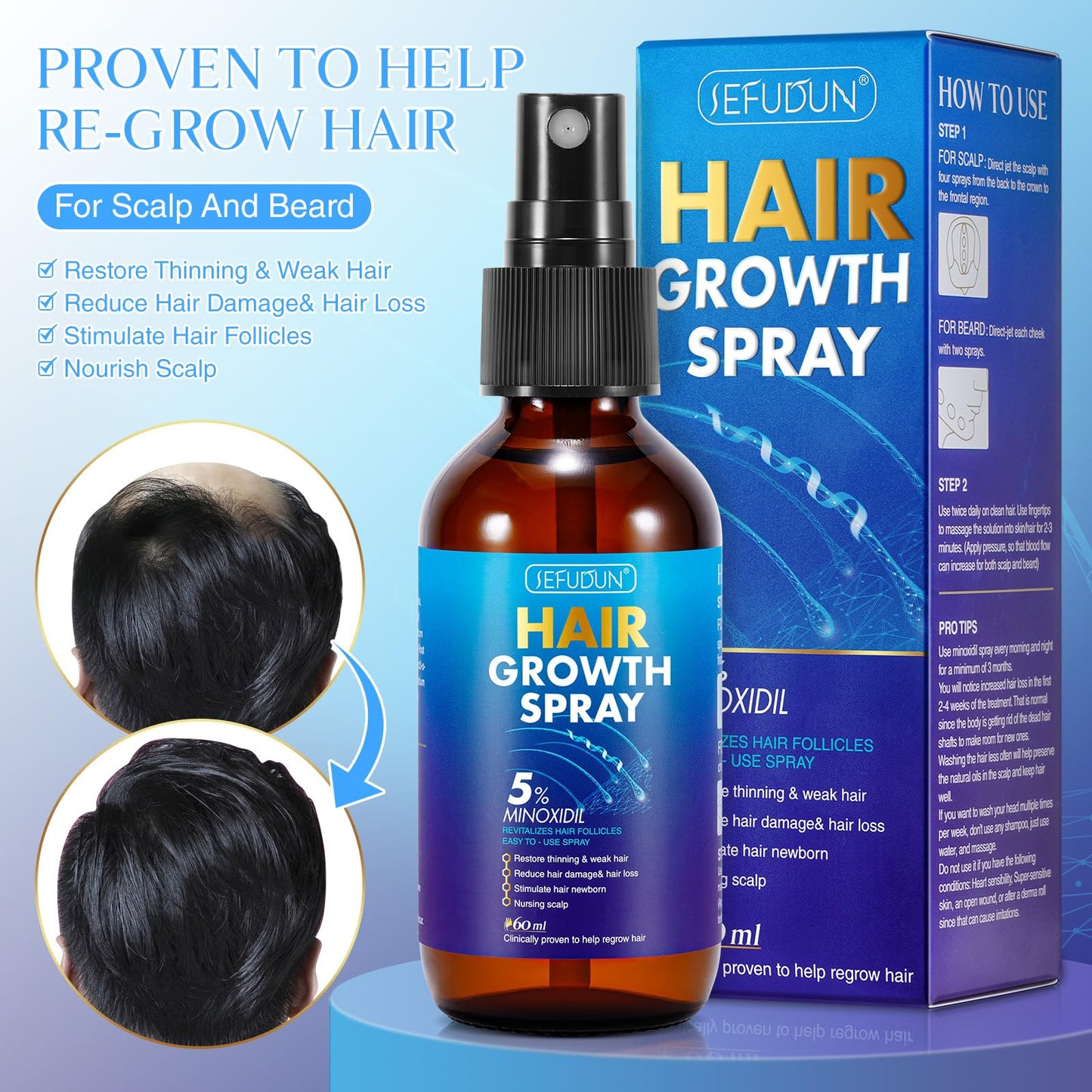 5% Minoxidil Hair Growth Spray for Hair and Beard Regrowth & Restore Thinning and Weak Hair,Nursing Scalp Help Regrow Hair Reduce Hair Damage and Dair loss, for Men and Women,2.02 OZ