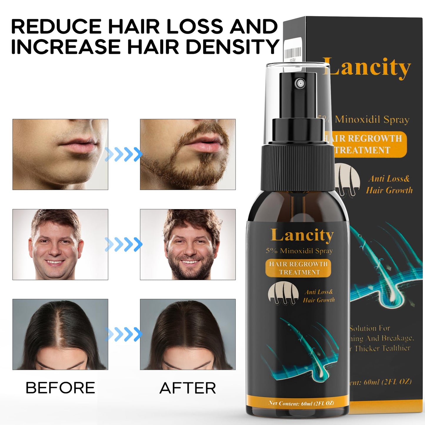 5% Minoxidil Spray Hair growth Serum, Hair Tonic Solution for Women & Men, Beard Growth Spray for Men, Hair Regrowth Treatment One Month Supply (One Bottle)