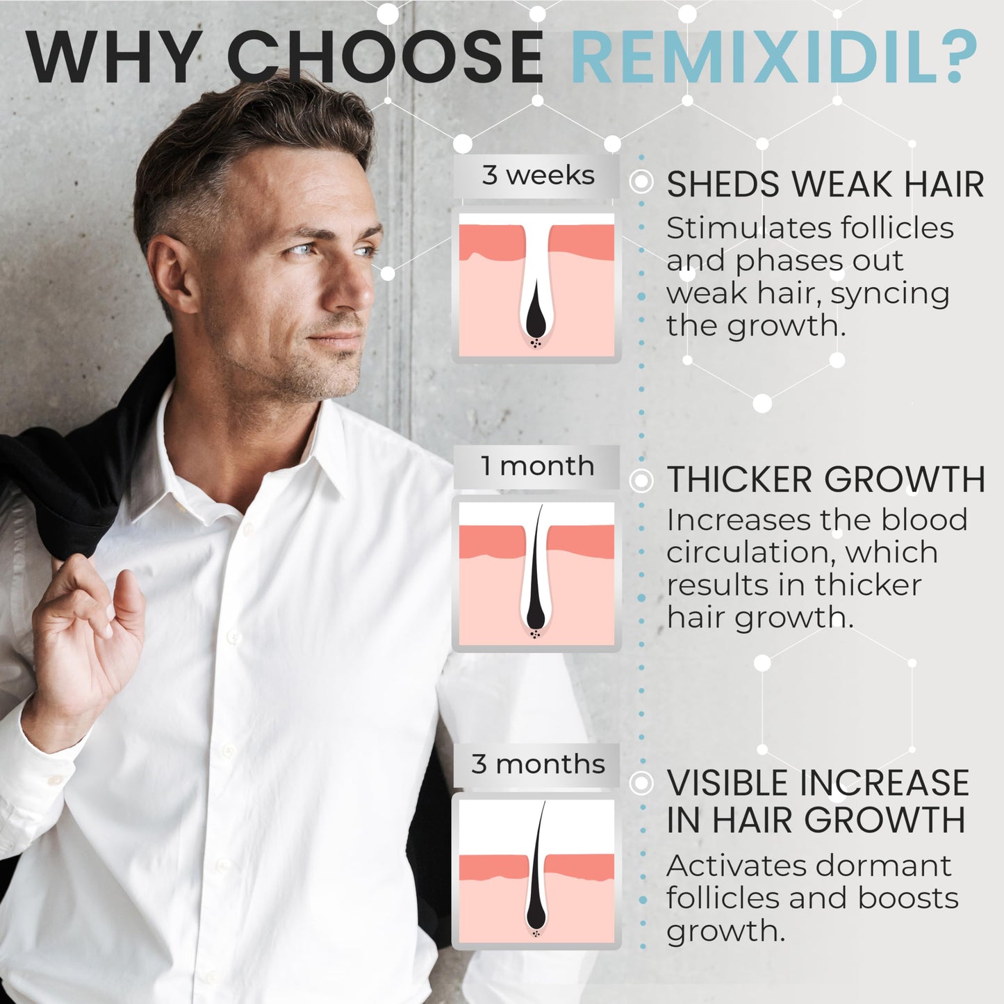 Remixidil Men’s 5% Minoxidil Spray | Hair Regrowth Treatment for Men|Clinically Proven Formula for Hair Loss and Hair Growth | Unscented Topical Spray Treatment for Thinning Hair |1 to 2 Month Supply