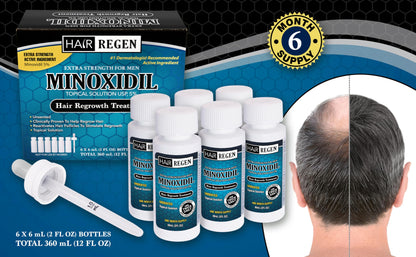 Hair-Regen Advanced 5% Minoxidil Hair Regrowth Treatment for Men- 6 Month Supply, Hair Loss Treatment, Minoxidil Topical Solution for Thicker, Fuller Hair
