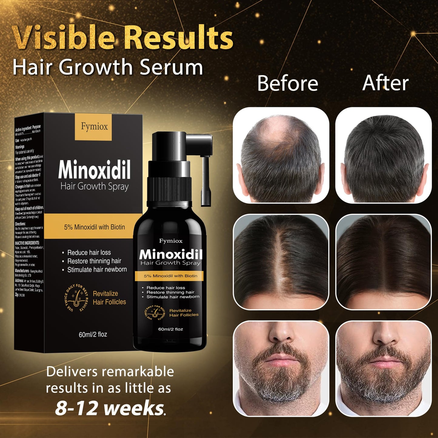 5% Minoxidil for Men and Women Hair Growth Oil, Minoxidil 5 Percent Spray, Biotin Hair Growth Serum, Natural Hair Regrowth Treatment for Hair Loss Hair Thinning, Thicker Fuller Healthier Hair 60ml