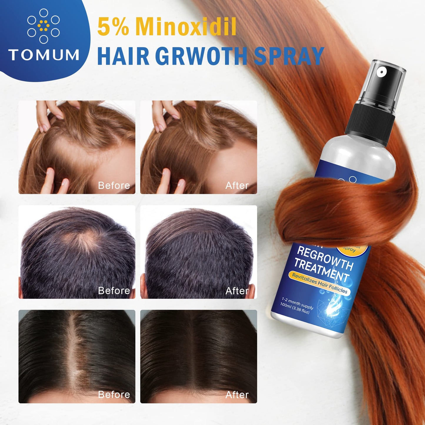 RELLET 5% Minoxidil Hair Growth Spray For Men and Women 100Ml Hair Regrowth Treatment Serum For Stronger Thicker Longer Hair Help to Stop Thinning and loss hair 2 Month supply